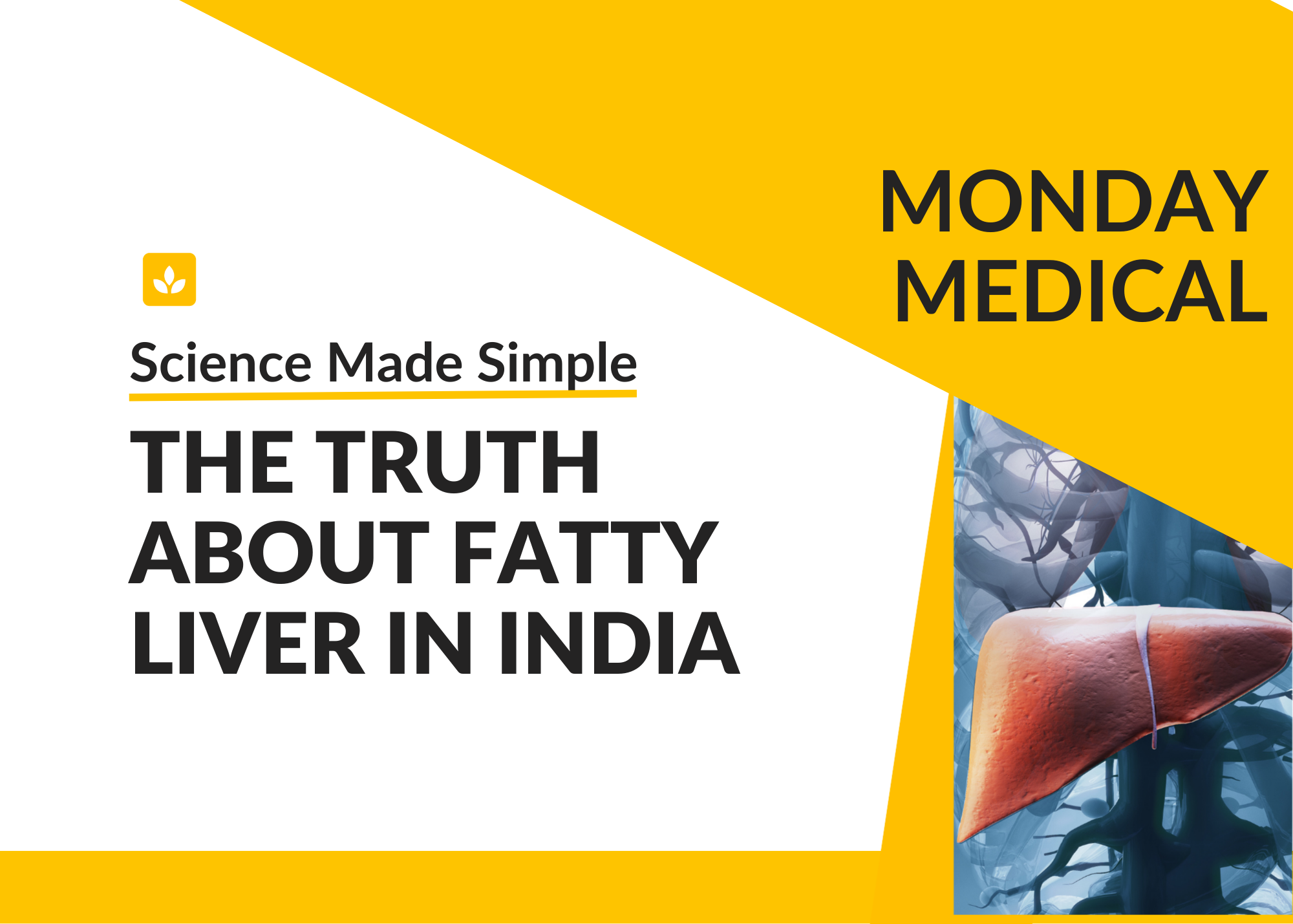 Monday Medical: The Truth About Fatty Liver in India
