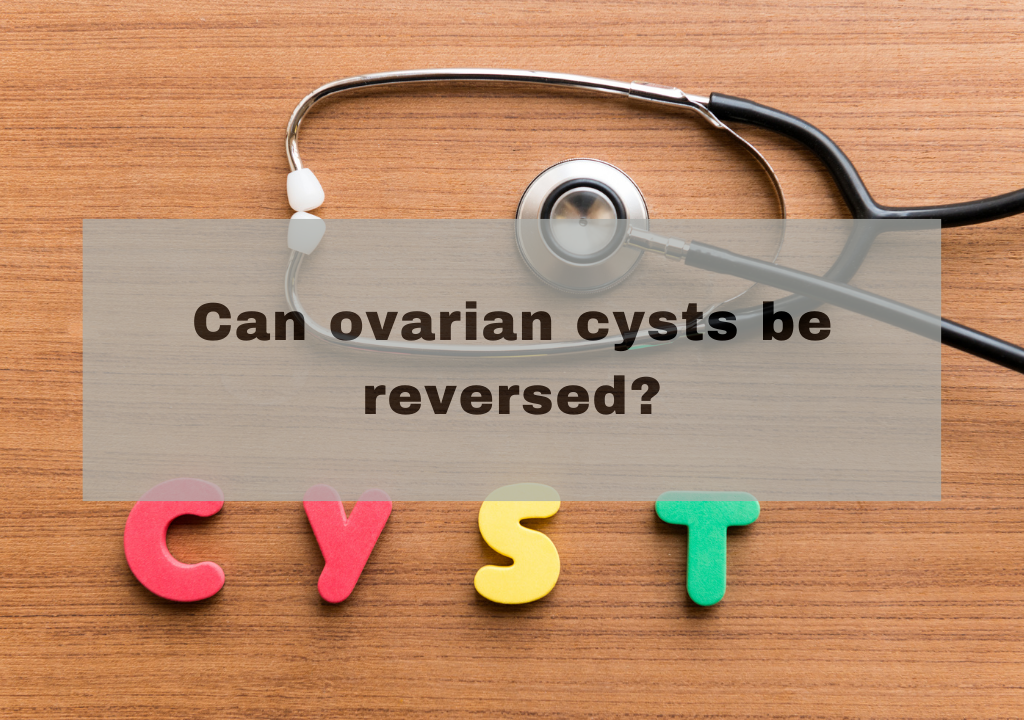Can ovarian cysts be reversed?